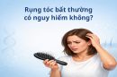 Rụng tóc bất thường có nguy hiểm không? Đừng chủ quan khi tóc rụng nhiều mỗi ngày