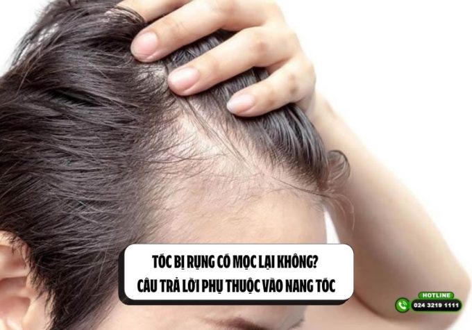 Tóc bị rụng có mọc lại không? Câu trả lời phụ thuộc vào nang tóc