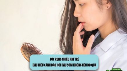 Tóc rụng nhiều khi trẻ: Dấu hiệu cảnh báo hói đầu sớm không nên bỏ qua