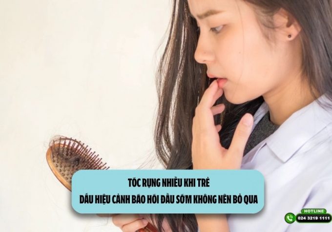 Tóc rụng nhiều khi trẻ: Dấu hiệu cảnh báo hói đầu sớm không nên bỏ qua