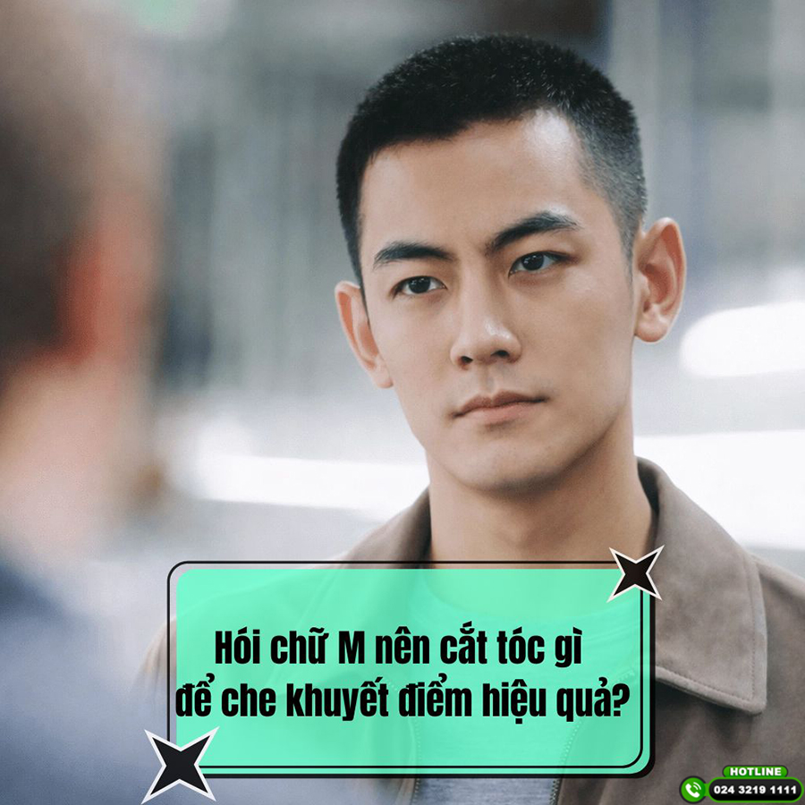 Hói chữ M nên cắt tóc gì để che khuyết điểm hiệu quả?