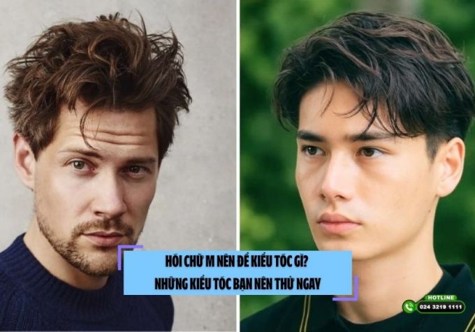 Hói chữ M nên để kiểu tóc gì? Những kiểu tóc bạn nên thử ngay