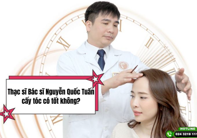 Thạc sĩ Bác sĩ Nguyễn Quốc Tuấn cấy tóc có tốt không? Review thực tế từ khách hàng