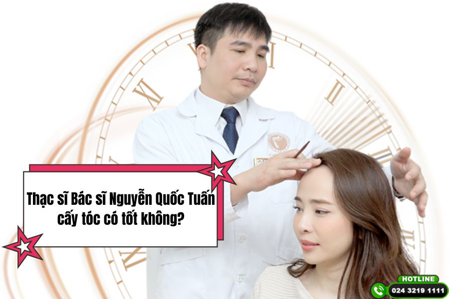 Thạc sĩ Bác sĩ Nguyễn Quốc Tuấn cấy tóc có tốt không? Review thực tế từ khách hàng