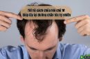 Tiết lộ cách chữa hói chữ M giúp lấy lại đường chân tóc tự nhiên