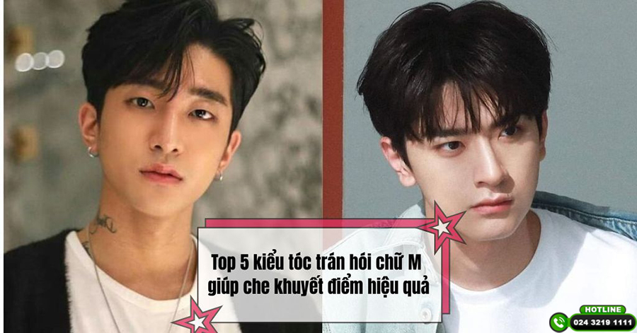 Top 5 kiểu tóc trán hói chữ M giúp che khuyết điểm hiệu quả