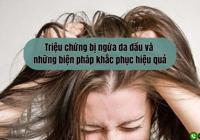 Triệu chứng bị ngứa da đầu và những biện pháp khắc phục hiệu quả