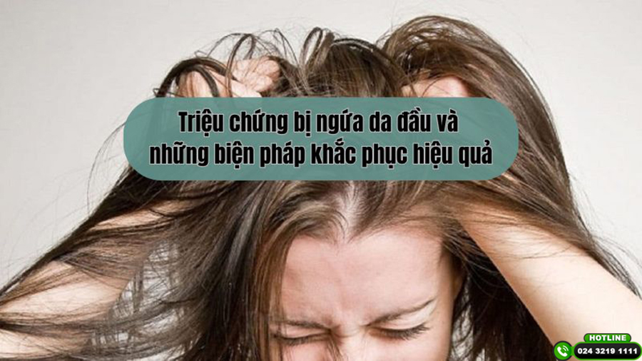 Triệu chứng bị ngứa da đầu và những biện pháp khắc phục hiệu quả