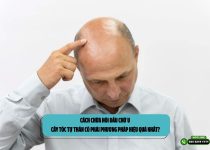 Cách chữa hói đầu chữ U: Cấy tóc tự thân có phải phương pháp hiệu quả nhất?