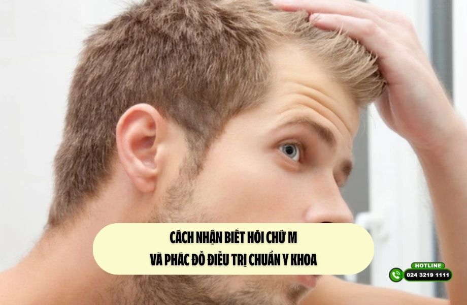 Cách nhận biết hói chữ M và phác đồ điều trị chuẩn y khoa 