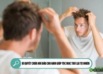 Bí quyết chữa hói đầu cho nam giúp tóc mọc trở lại tự nhiên