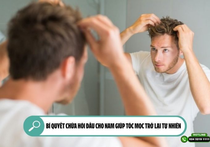 Bí quyết chữa hói đầu cho nam giúp tóc mọc trở lại tự nhiên