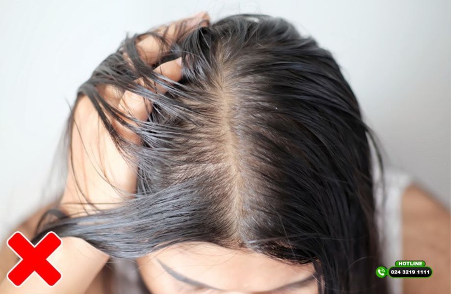 Ngủ dậy thấy tóc rụng đầy gối - Đêm ngủ hay bị rụng tóc do đâu?