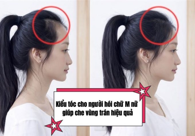 TOP 7 kiểu tóc cho người hói chữ M nữ giúp che vùng trán hiệu quả