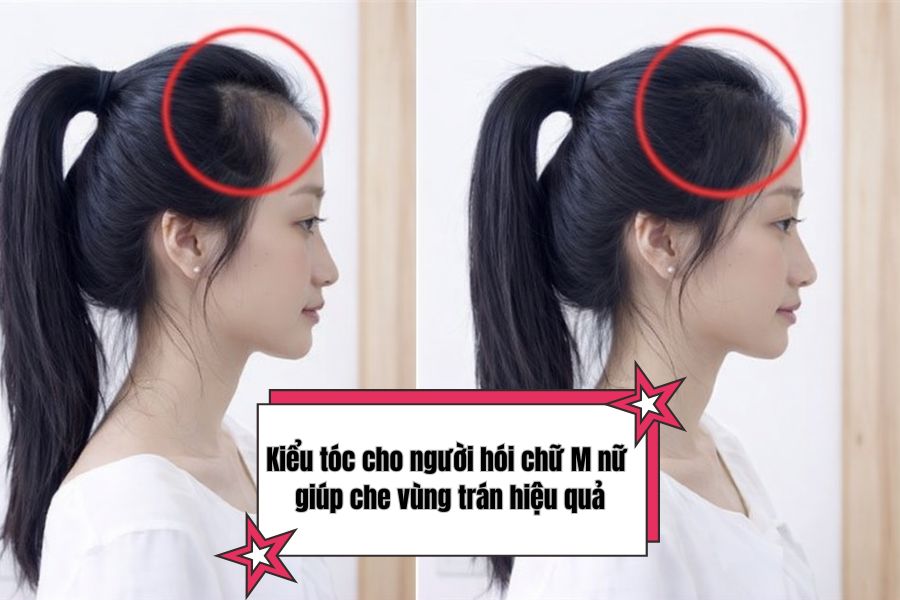 TOP 7 kiểu tóc cho người hói chữ M nữ giúp che vùng trán hiệu quả