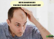 Kiểu tóc cho người hói chữ U: Vì sao càng cố tạo kiểu càng dễ lộ khuyết điểm?