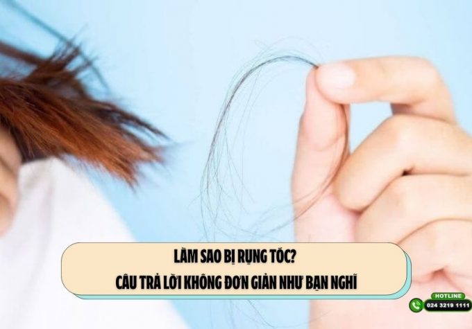 Làm sao bị rụng tóc? Câu trả lời không đơn giản như bạn nghĩ