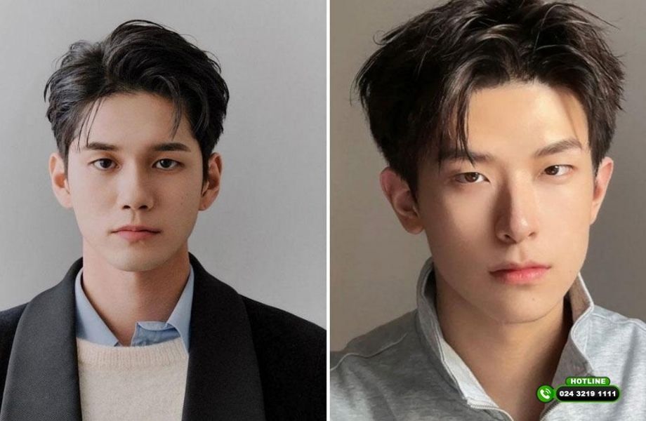 Kiểu tóc cho người hói chữ M nam: Chọn sao để che khuyết điểm hiệu quả?