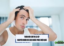 Trán hói chữ M là gì? Nguyên nhân và cách khắc phục hiệu quả