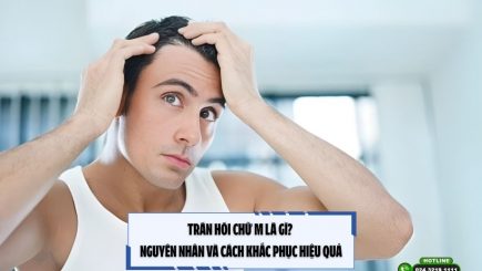 Trán hói chữ M là gì? Nguyên nhân và cách khắc phục hiệu quả