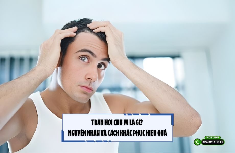 Trán hói chữ M là gì? Nguyên nhân và cách khắc phục hiệu quả
