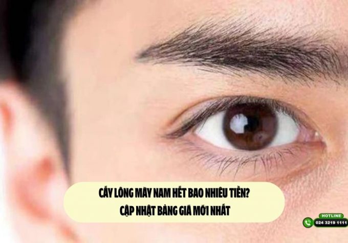 Cấy lông mày nam hết bao nhiêu tiền? Cập nhật bảng giá mới nhất