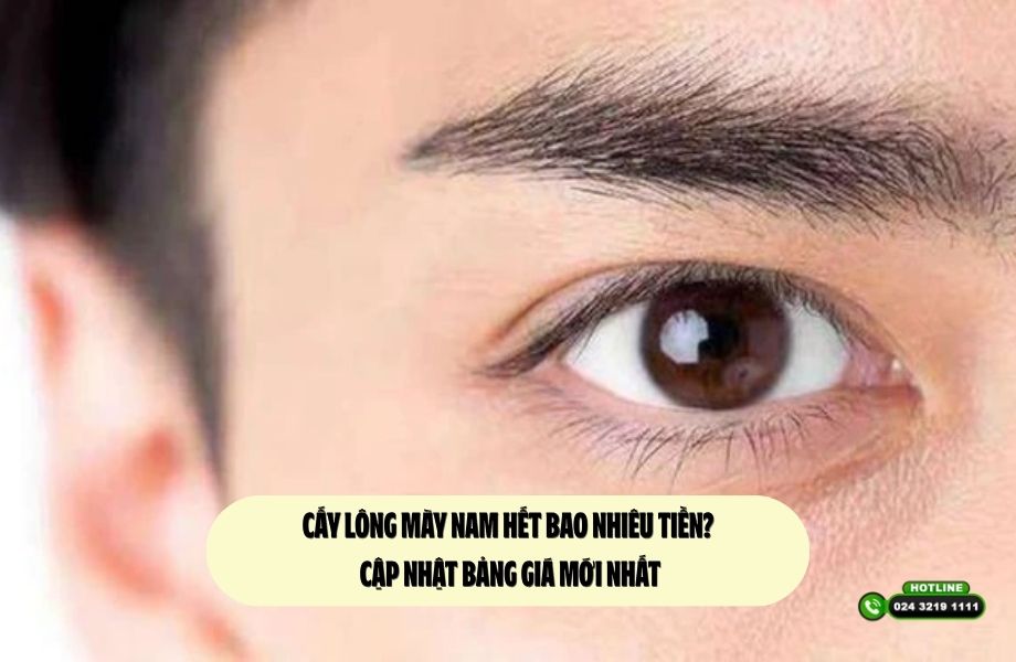 Cấy lông mày nam hết bao nhiêu tiền? Cập nhật bảng giá mới nhất