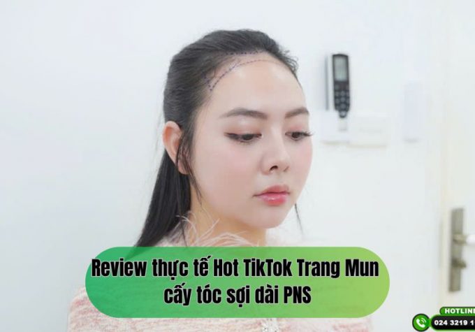 Review thực tế Hot TikTok Trang Mun cấy tóc sợi dài PNS