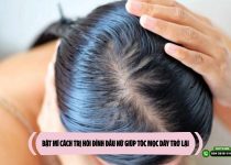 Bật mí cách trị hói đỉnh đầu nữ giúp tóc mọc dày trở lại