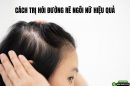 Chuyên gia tiết lộ 2 cách trị hói đường rẽ ngôi nữ hiệu quả