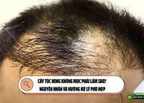 Cấy tóc xong không mọc phải làm sao? Nguyên nhân và hướng xử lý phù hợp