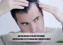 Đàn ông hói đầu có già hơn tuổi không? Chuyên gia phân tích từ phương diện thẩm mỹ và tâm lý