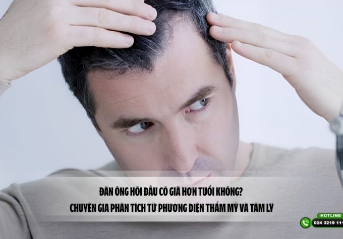 Đàn ông hói đầu có già hơn tuổi không? Chuyên gia phân tích từ phương diện thẩm mỹ và tâm lý