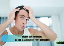 Dấu hiệu nang tóc còn sống: Bác sĩ chỉ ra cách nhận biết trước khi quá muộn