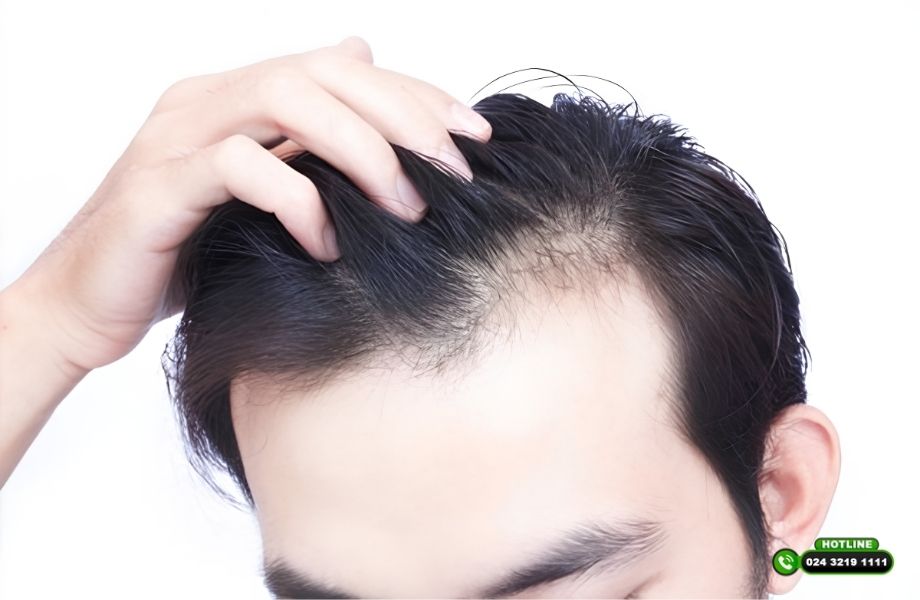 Dấu hiệu nang tóc còn sống: Bác sĩ chỉ ra cách nhận biết trước khi quá muộn