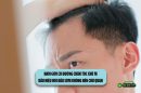Nam giới có đường chân tóc chữ M: Dấu hiệu hói đầu sớm không nên chủ quan