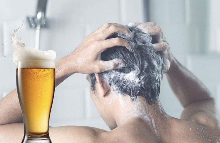 Gợi ý 3 cách trị vảy gàu da đầu hiệu quả, đơn giản tại nhà