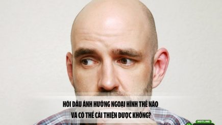 Hói đầu ảnh hưởng ngoại hình thế nào và có thể cải thiện được không?
