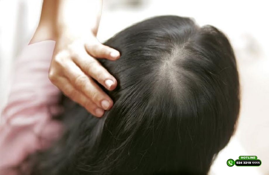 Cách chữa hói đỉnh đầu nữ hiệu quả: Góc nhìn chuyên gia và giải pháp cá nhân hóa