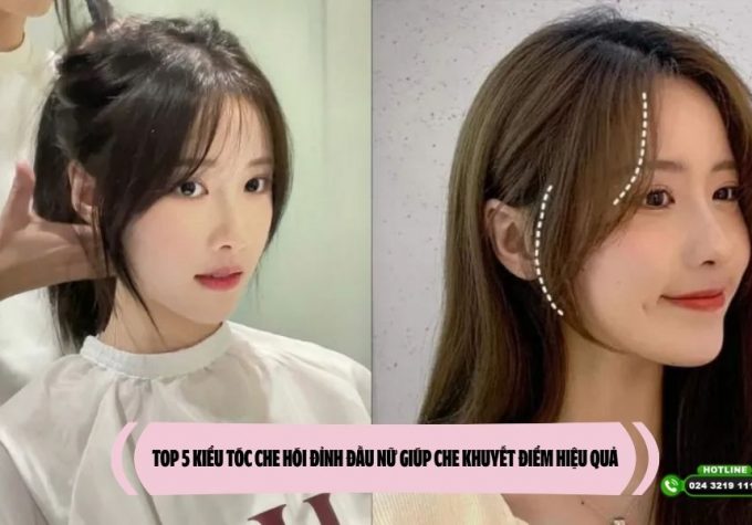 TOP 5 kiểu tóc che hói đỉnh đầu nữ giúp che khuyết điểm hiệu quả