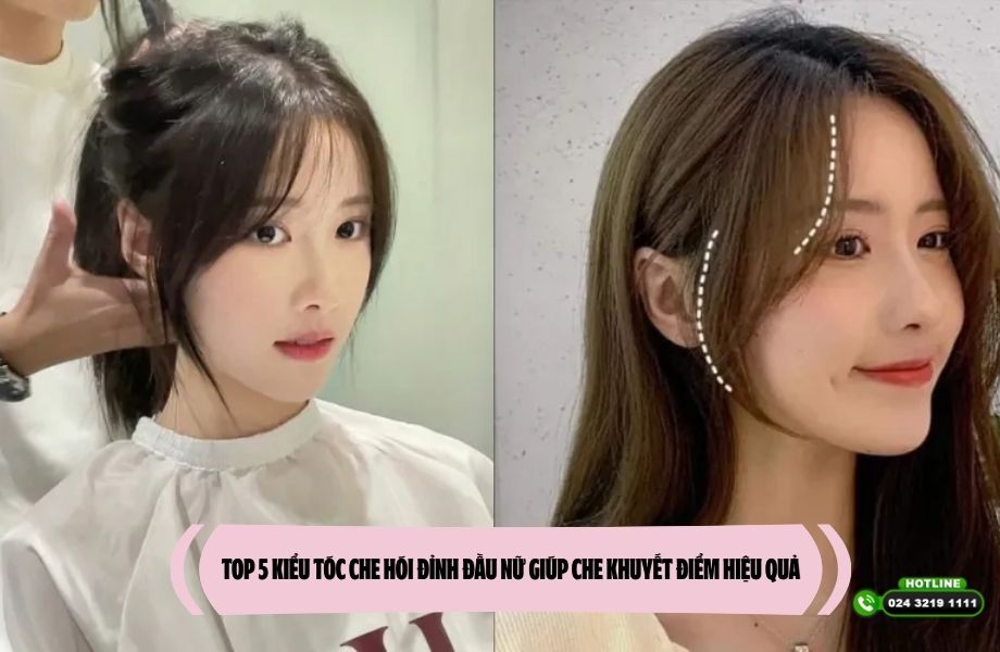 TOP 5 kiểu tóc che hói đỉnh đầu nữ giúp che khuyết điểm hiệu quả