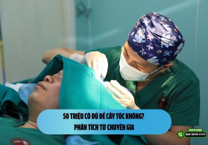 50 triệu có đủ để cấy tóc không? Phân tích từ chuyên gia