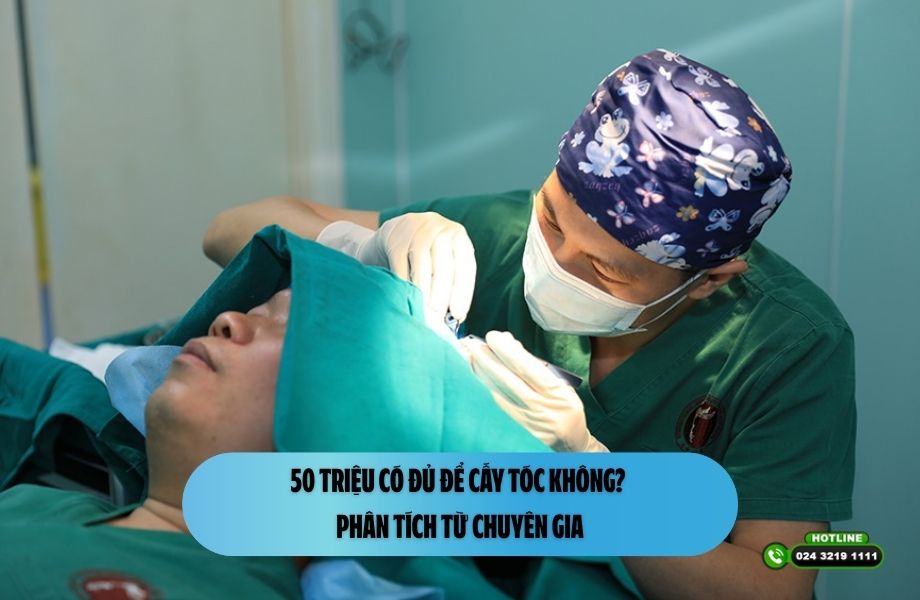 50 triệu có đủ để cấy tóc không? Phân tích từ chuyên gia