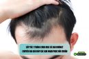 Cấy tóc 1 tháng chưa mọc có sao không? Chuyên gia giải đáp các giai đoạn phục hồi chuẩn