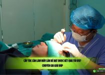 Cấy tóc cần làm mấy lần để đạt được kết quả tối ưu? Chuyên gia giải đáp