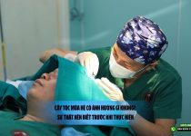 Cấy tóc mùa hè có ảnh hưởng gì không? Sự thật nên biết trước khi thực hiện