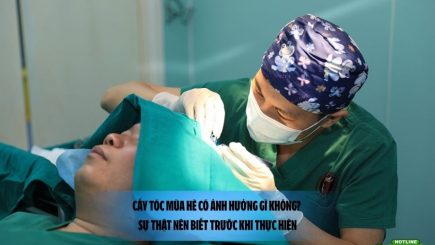 Cấy tóc mùa hè có ảnh hưởng gì không? Sự thật nên biết trước khi thực hiện