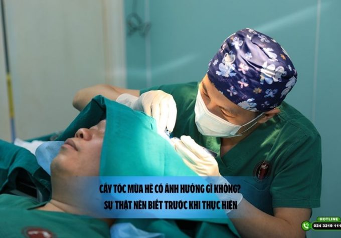 Cấy tóc mùa hè có ảnh hưởng gì không? Sự thật nên biết trước khi thực hiện