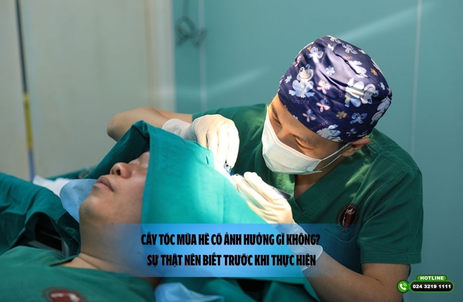 Cấy tóc mùa hè có ảnh hưởng gì không? Sự thật nên biết trước khi thực hiện