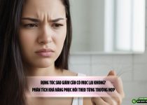 Rụng tóc sau giảm cân có mọc lại không? Phân tích khả năng phục hồi theo từng trường hợp